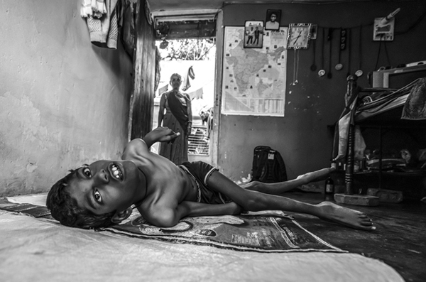 'Toxic Trespass' Crianças afectadas pela tragédia de Bhopal na Índia - Foto de Giles Clarke (EUA)