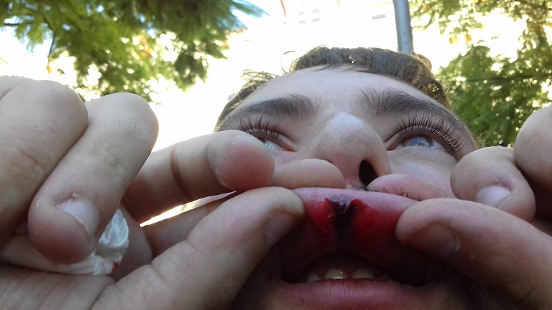 Segundo o SOS RACISMO, um dos manifestantes espanhóis foi agredido, ficando com o lábio aberto e várias escoriações na face